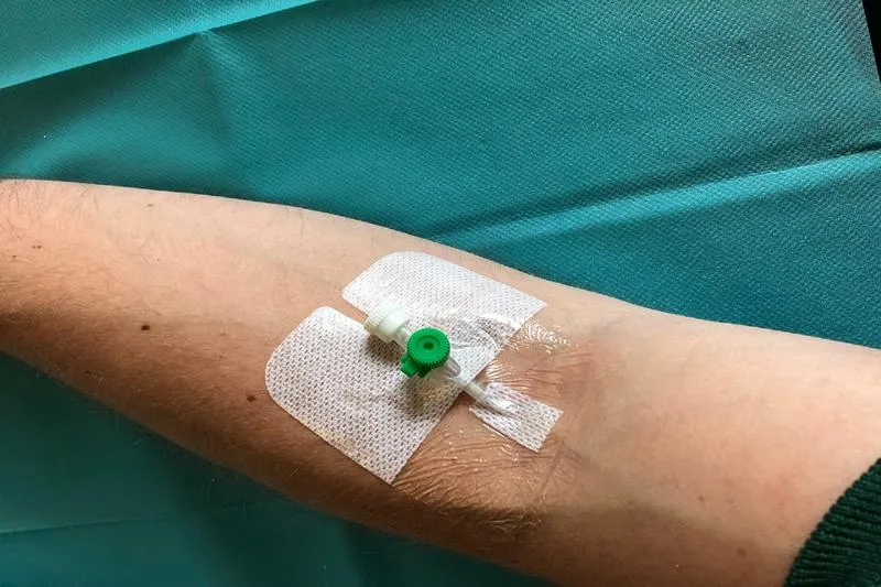 Wenflon pomarańczowy w praktyce: Kiedy i jak go stosować w medycynie?