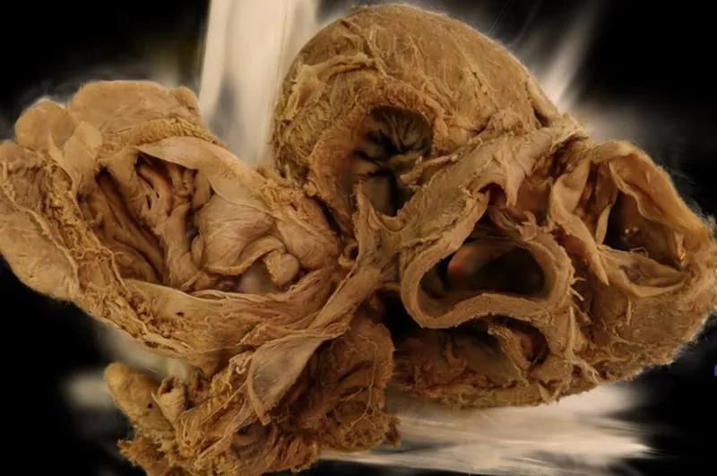 Nowoczesne metody tworzenia preparatów anatomicznych