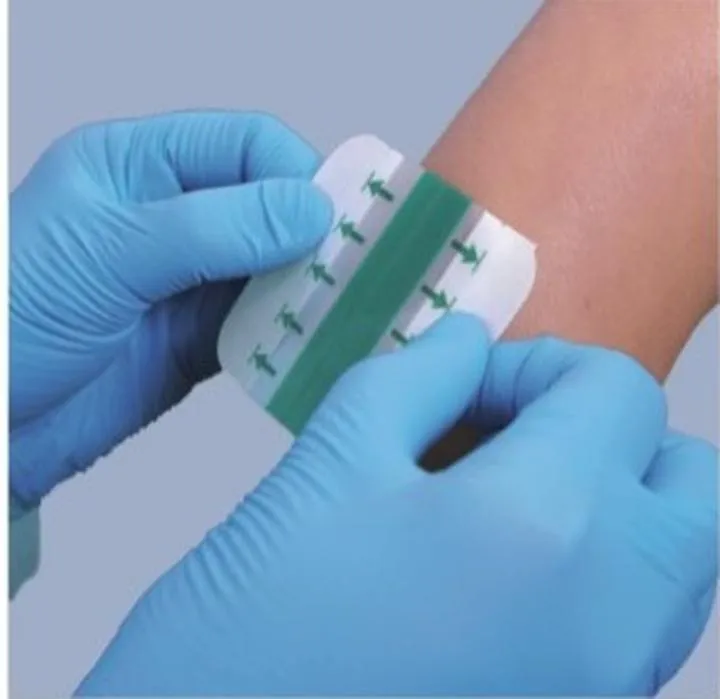 Technologia działania opatrunków