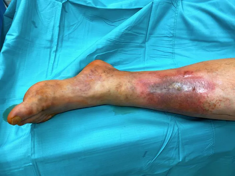 Terapie biologiczne